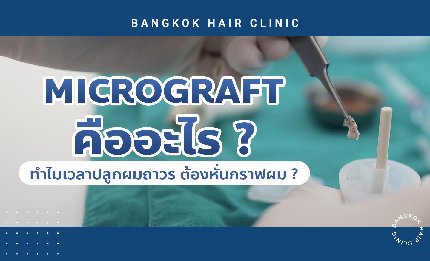 Micrograft คืออะไร ? ทำไมเวลาปลูกผมถาวร ต้องหั่นกราฟผม ?