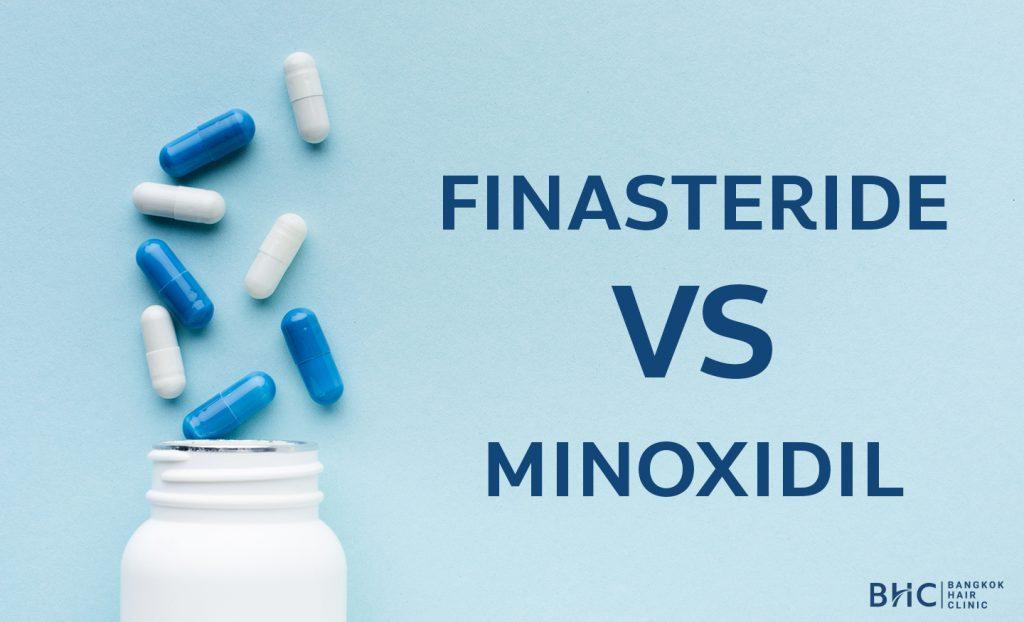 ยาลดผมร่วง Finasteride คือที่จะทำการยับยั้งการสร้างของฮอร์โมน DHT
