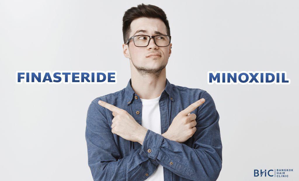 การเลือกยาลดผมร่วง Finasteride และ Minoxidil