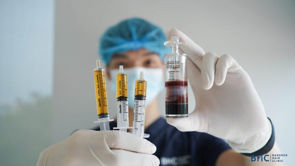 PRP hair treatment is made from your own blood. 