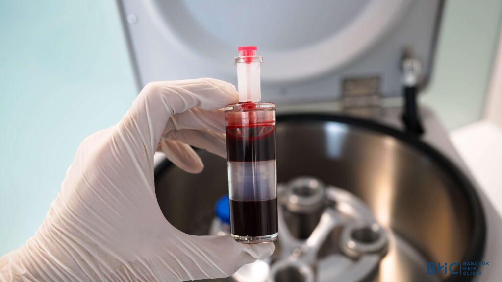 A centrifuge separates the blood components. 