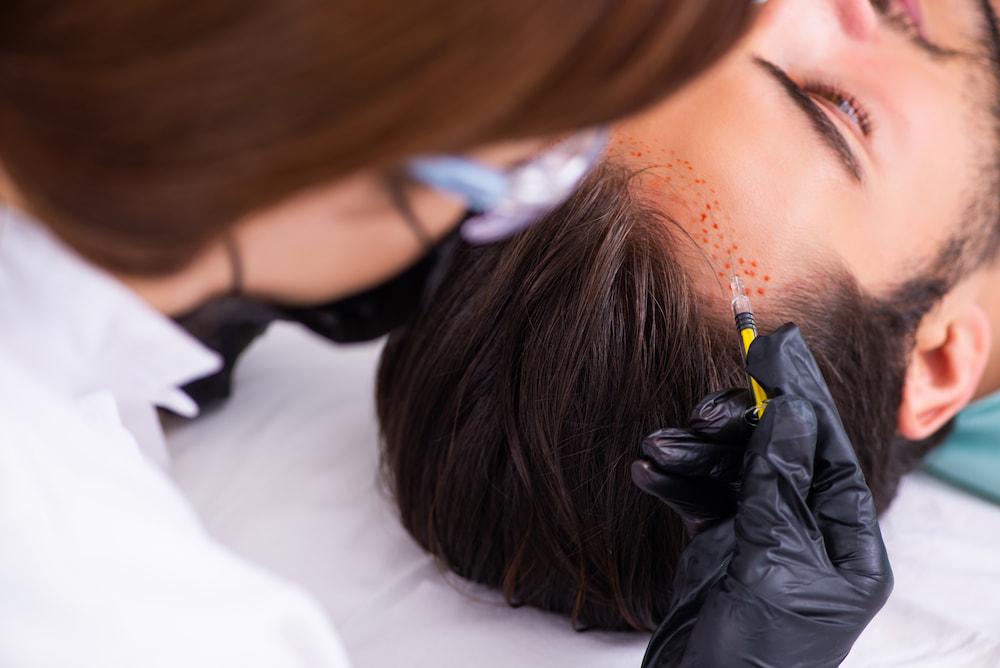 Embrace a Fuller Mane with Natural Hair Regrowth Treatments