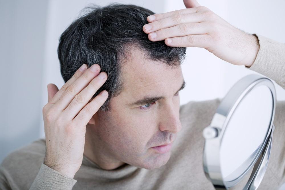 Different Types of Hair Loss & Causes