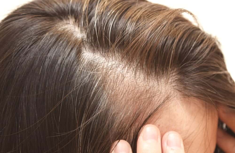 สาเหตุของผมลีบแบน พร้อมวิธีแก้ไข และทรงผมที่ใช่สำหรับคุณ