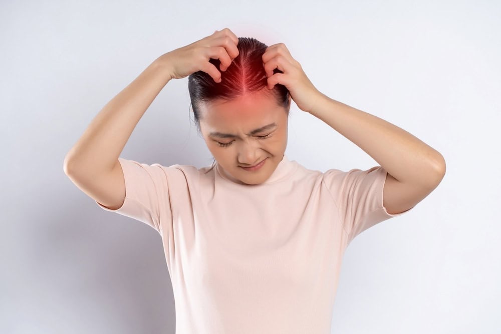 Get Help for Scalp Fungus Infections