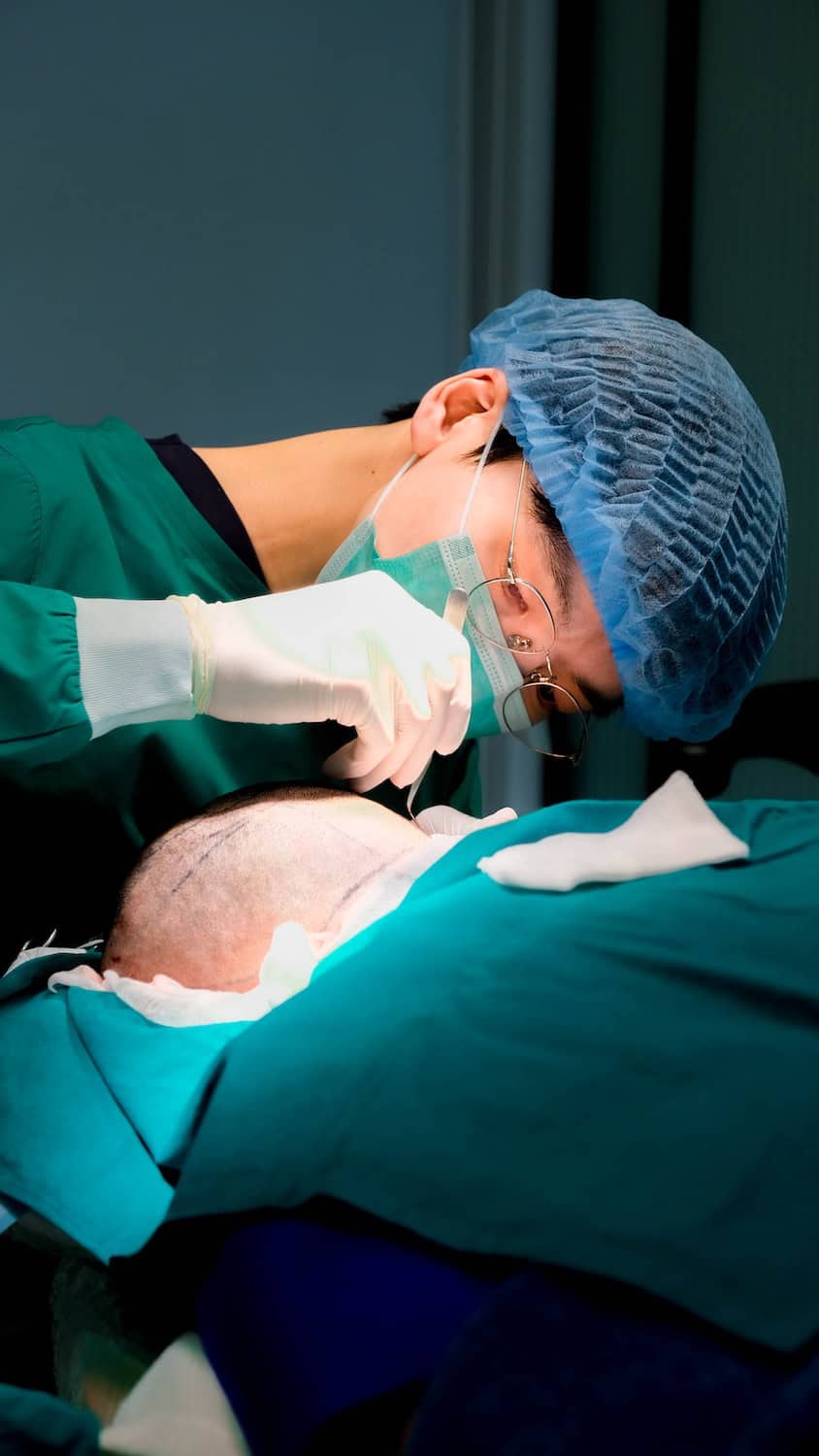 DHI micrograft hair transplant procedure in Thailand