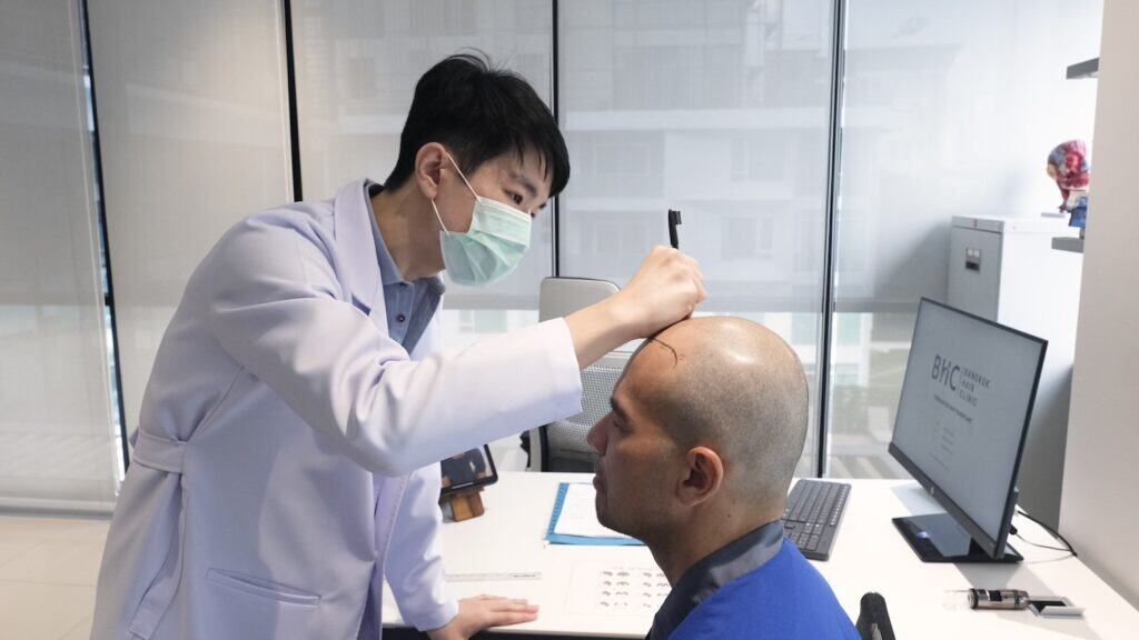 DHI hair transplant consultation in Bangkok for a patient