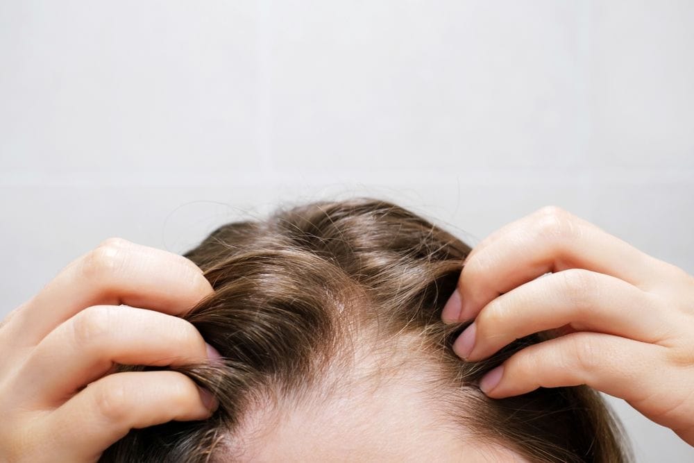 Zinc for Hair Loss: Complete Explanation