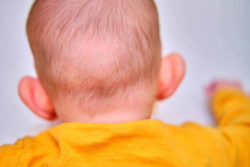 Why Hair Loss Happens in Children and How to Prevent It