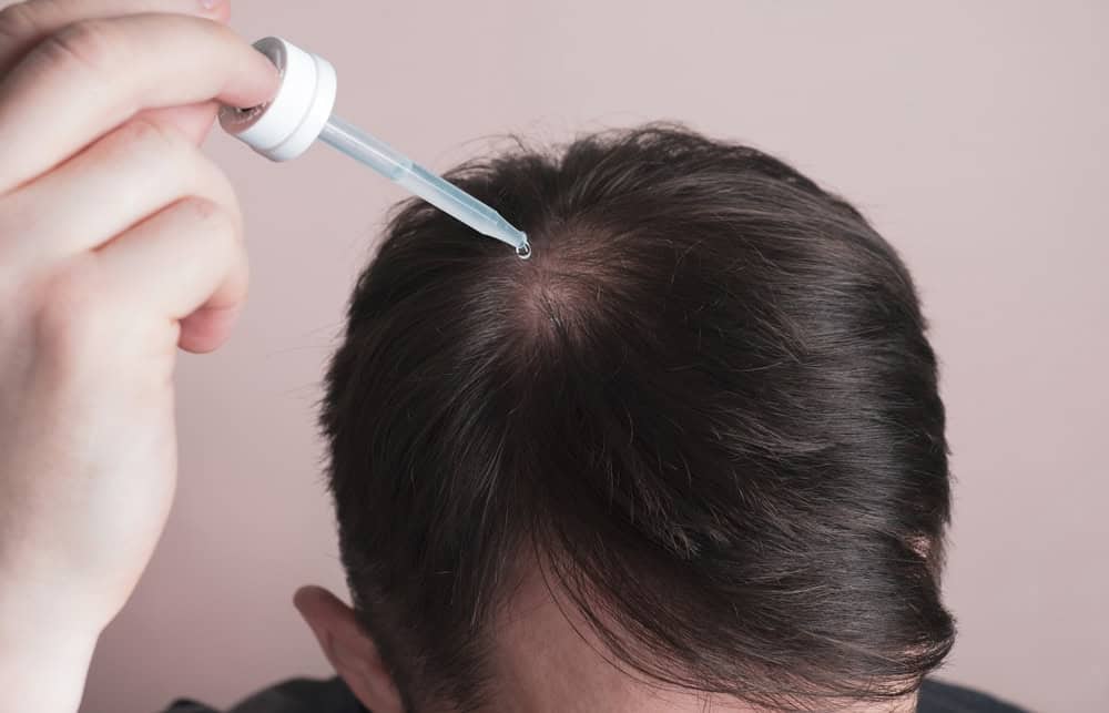 A man applying topical minoxidil for men to his hairline