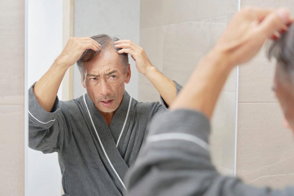 Alopecia Areata in Older Adults: Diagnosis and Care